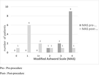 Safety and effectiveness of thermal radiofrequency applied to the musculocutaneous nerve for patients with spasticity